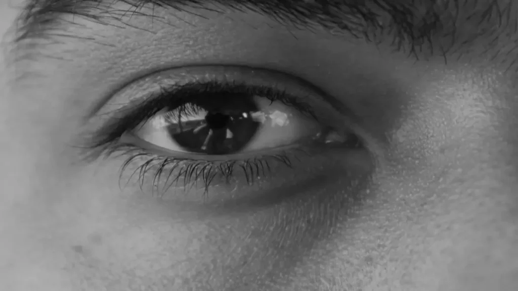 The Proven Minimalist Routine for Under-Eye Dark Circles 1 Dark circles under the eyes