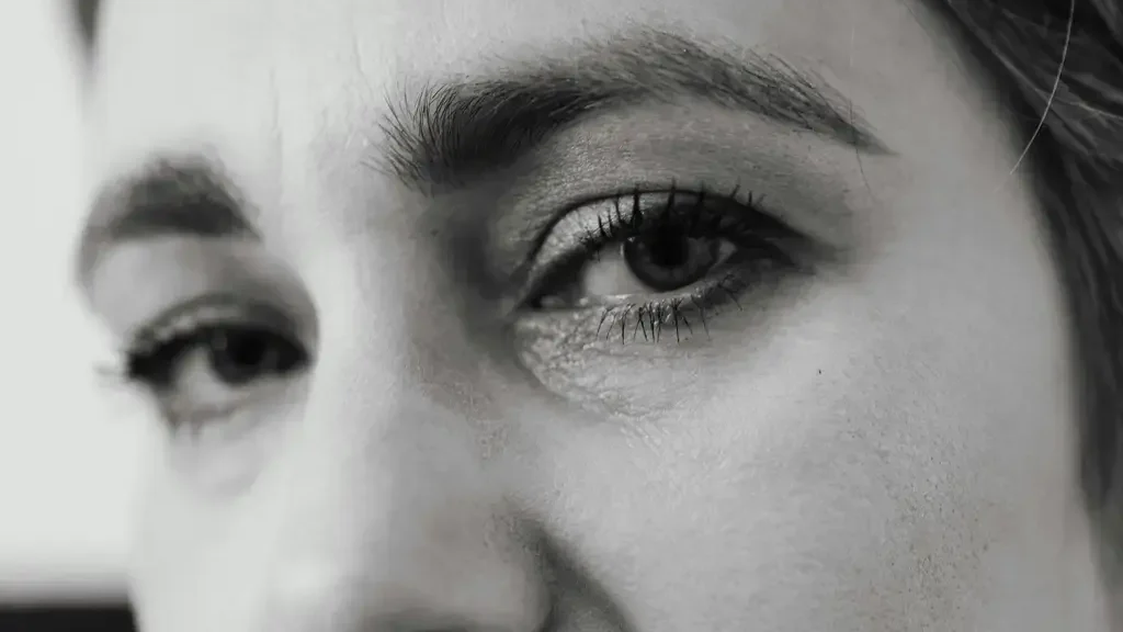 Dark Circles: Causes and Myths
